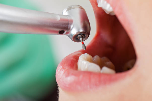 Best Emergency Dental Surgery in Oconto Falls, WI